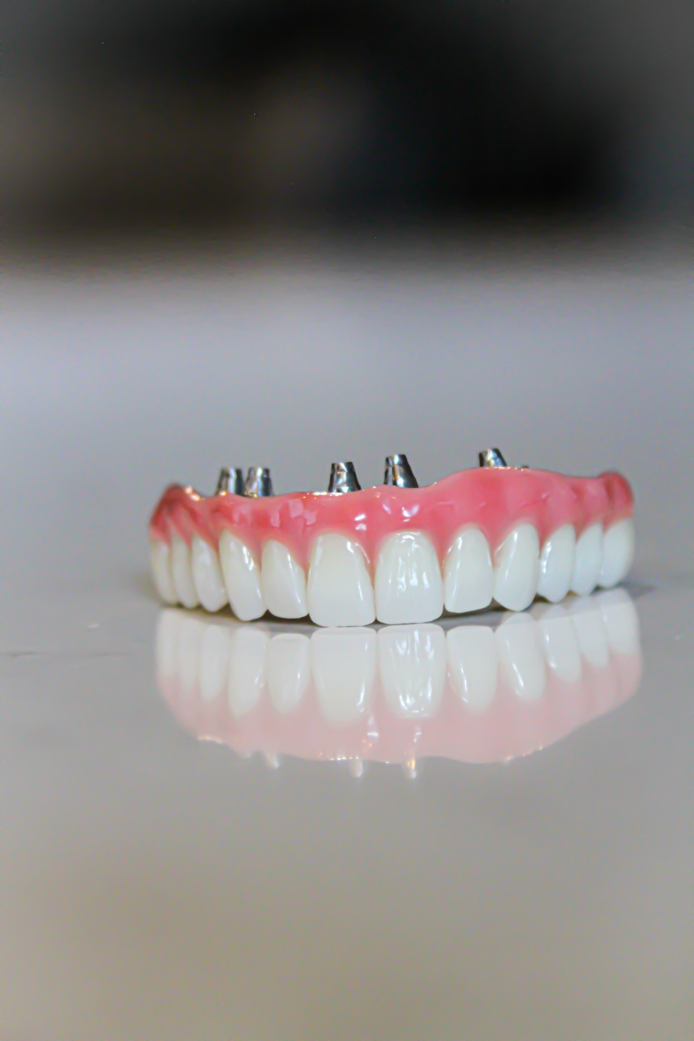 Full-arch implant restoration by Unident Art Dental Lab